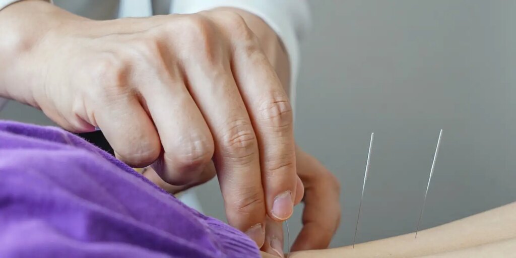 brasil-regulamenta-exercicio-profissional-da-acupuntura