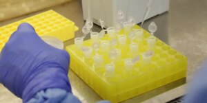 sp-confirma-segundo-caso-importado-de-sarampo