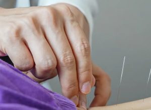 brasil-regulamenta-exercicio-profissional-da-acupuntura