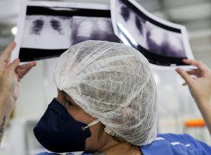 brasil-deve-ter-781-mil-novos-casos-de-cancer-por-ano-ate-2028