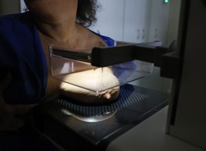 vigitel:-92%-das-brasileiras-entre-50-e-69-anos-fizeram-mamografia